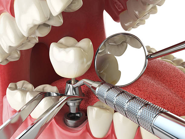 Best Tooth Infection Emergency Dentist  in Fort Myers Shores, FL