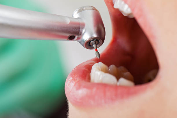 Best Cracked Tooth Emergency Dentist  in Fort Myers Shores, FL